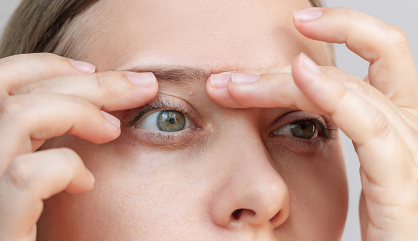 How to Prevent Milia: Keep Skin Clear Every Day 